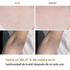 🎁 Compra Hoy: Dr. Melaxin™ Exfoliante Corporal + FRETE GRATIS